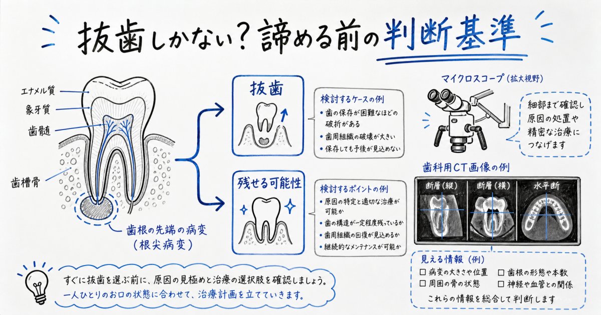 抜歯しかないと言われた歯を残せる可能性は？諦める前の判断基準